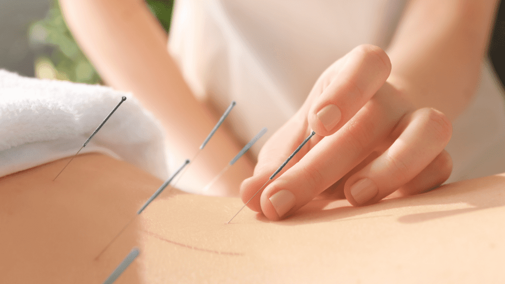 Peconic Acupuncture