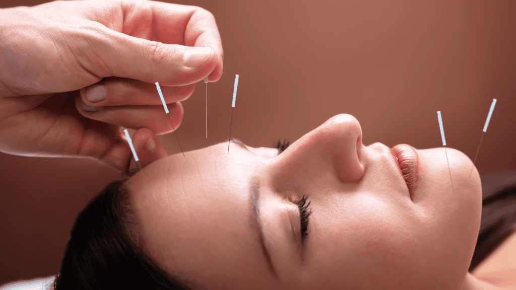 Chester Center Acupuncture