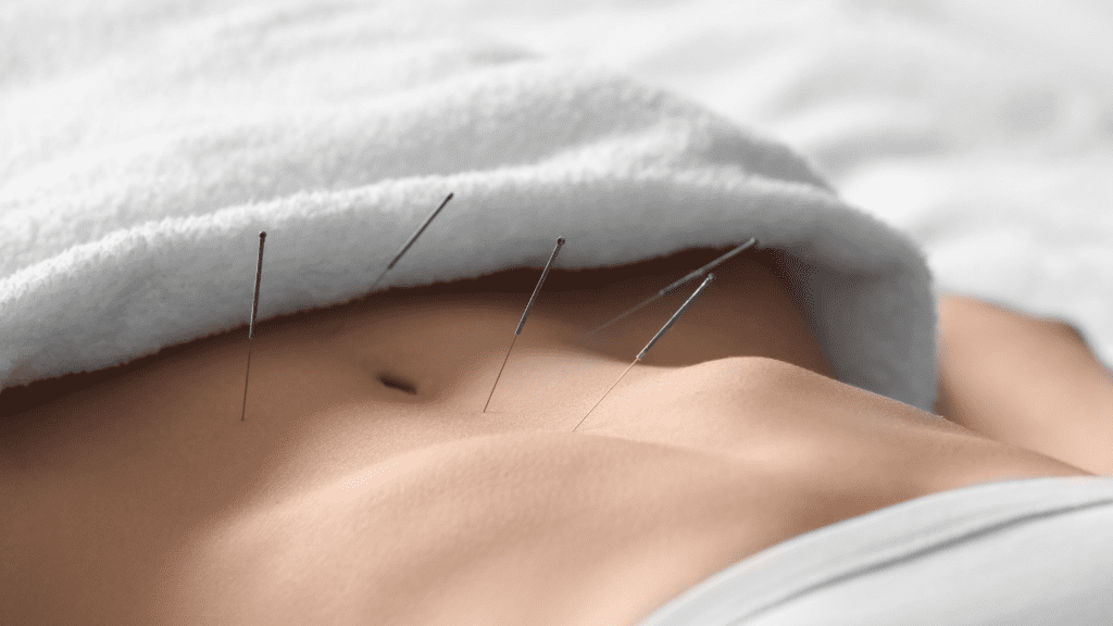 Clinton Acupuncture