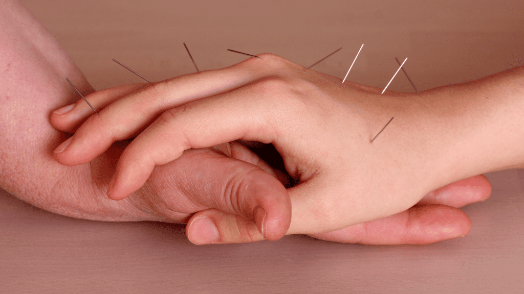 Moodus Acupuncture