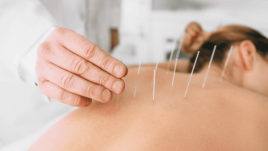 Chester Acupuncture
