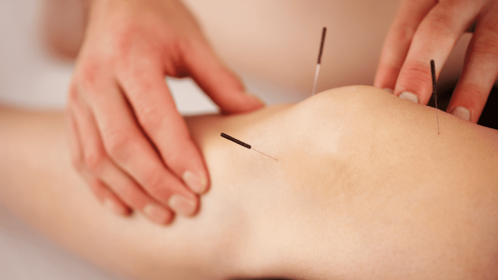 Pine Orchard Acupuncture