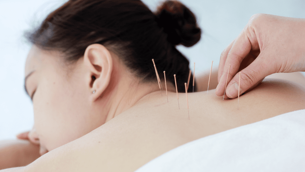 Madison Center Acupuncture